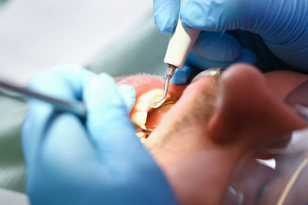 Best Orthodontic Emergency Dentist in Rolesville, NC